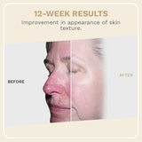 Elevai Exosome Regenerative Serum Daily Repair