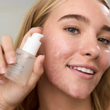 Omnilux Noni Balancing Serum