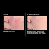 PCA Skin Anti-redness Serum