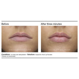 PCA Skin Hyaluronic Acid Lip Booster