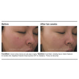 PCA Skin Retinol Treatment for Sensitive Skin