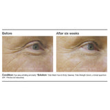 PCA Skin Total Strength Serum