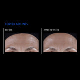 PCA Skin ExLinea® Pro Peptide Serum