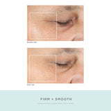 NuFace Trinity ELE Attachment