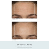 NuFace Trinity Wrinkle Reducer Attachment