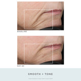 NuFace Trinity Wrinkle Reducer Attachment