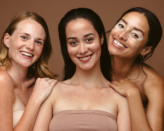 What Is Skin Positivity And Why Is It So Important?