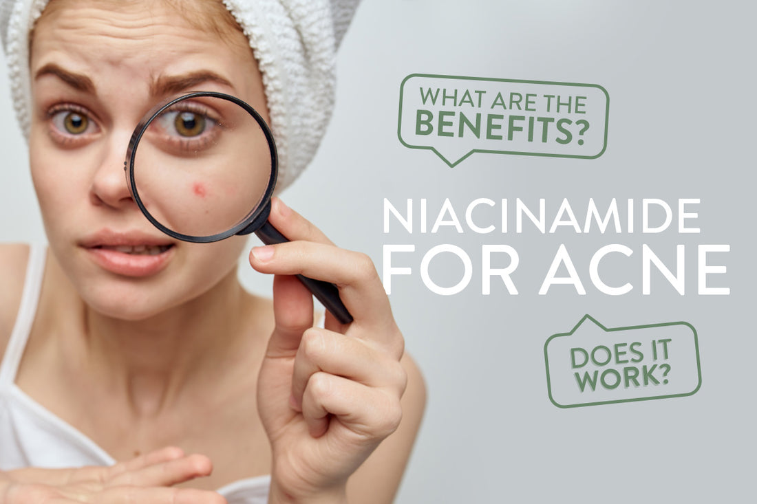 Niacinamide for Acne - Does It Work and What Are The Benefits?