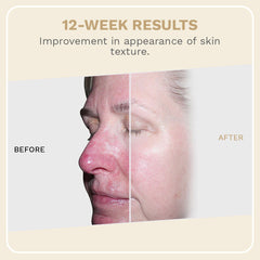 Elevai Exsome Regenerative Serum Daily Repair