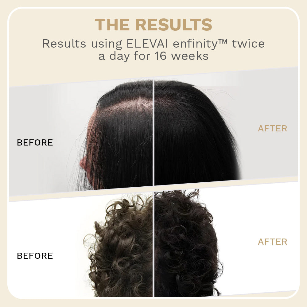 Elevai Root Renewal System™