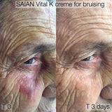 Saian Vital-K EYE Creme