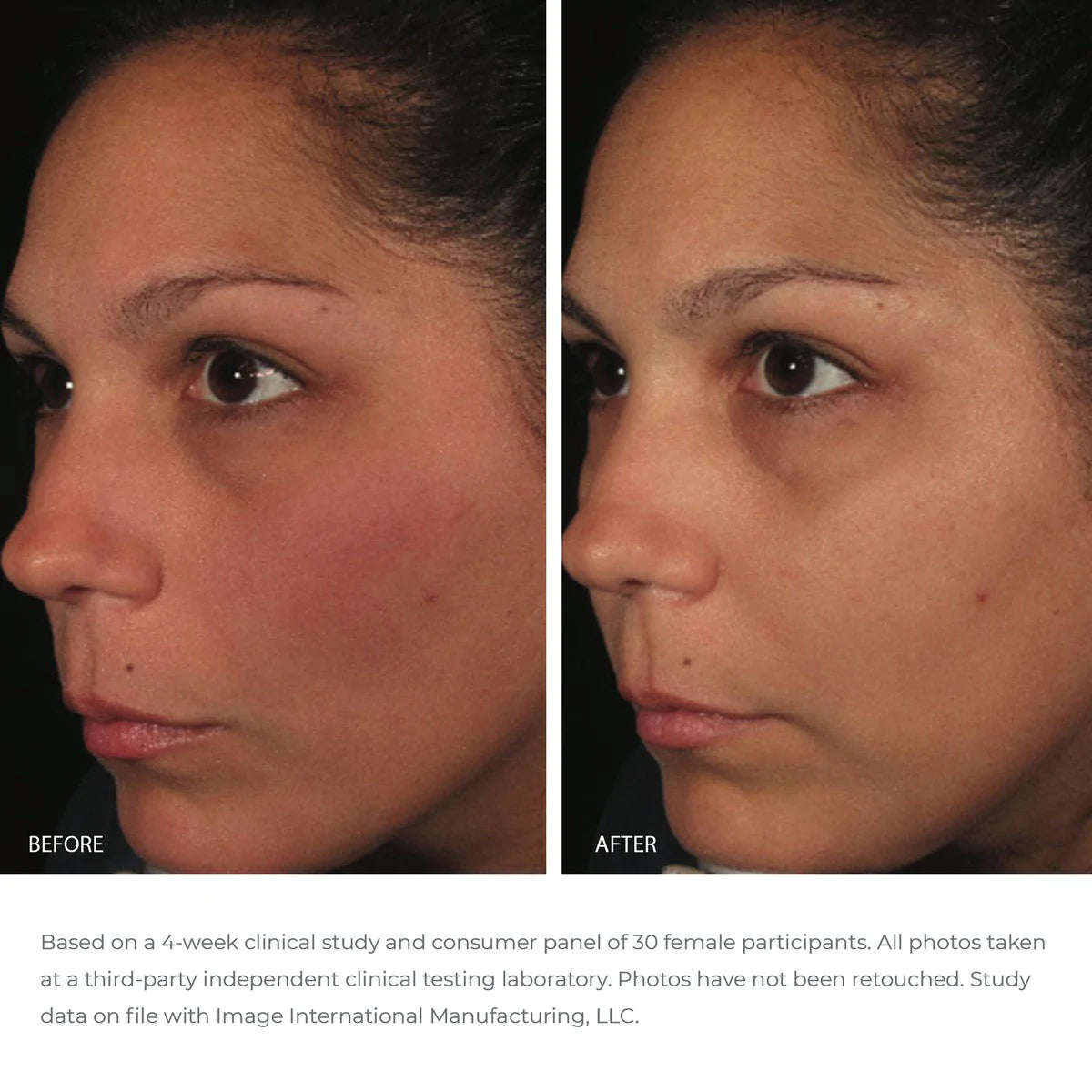 Image Skincare ORMEDIC Balancing Anti-Oxident Serum