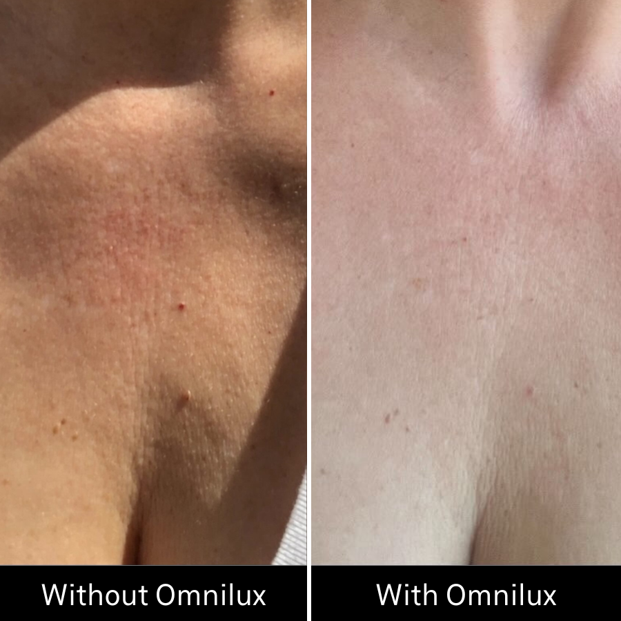 Omnilux Contour NECK & DÉCOLLETÉ