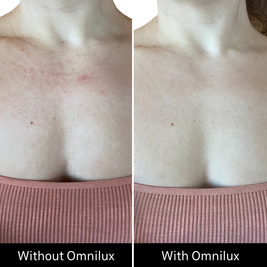 Omnilux Contour NECK & DÉCOLLETÉ