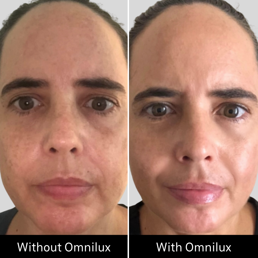 Omnilux Contour FACE