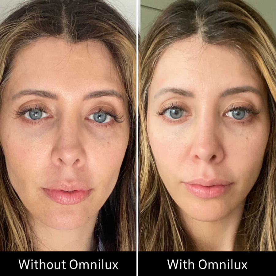 Omnilux Contour FACE