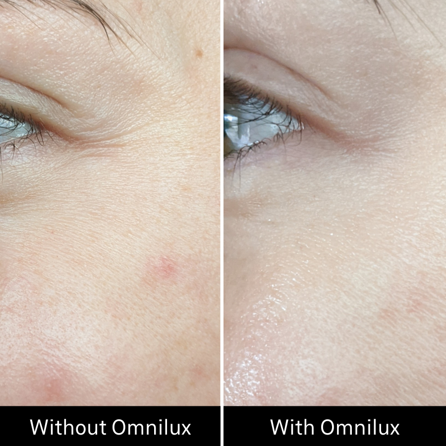 Omnilux Contour FACE