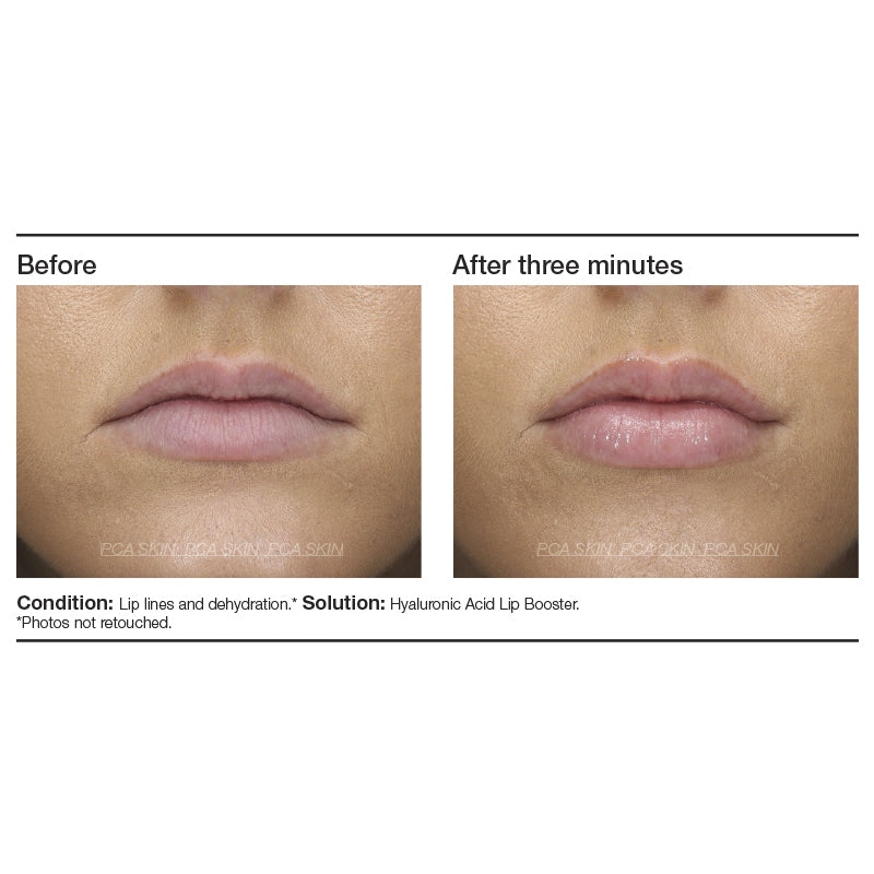 PCA Hyaluronic Acid Lip Booster