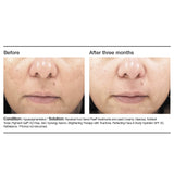 PCA Skin Pigment Gel HQ Free