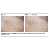 PCA Skin Pigment Gel HQ Free