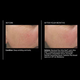 PCA Skin C-Quench Antioxidant Serum