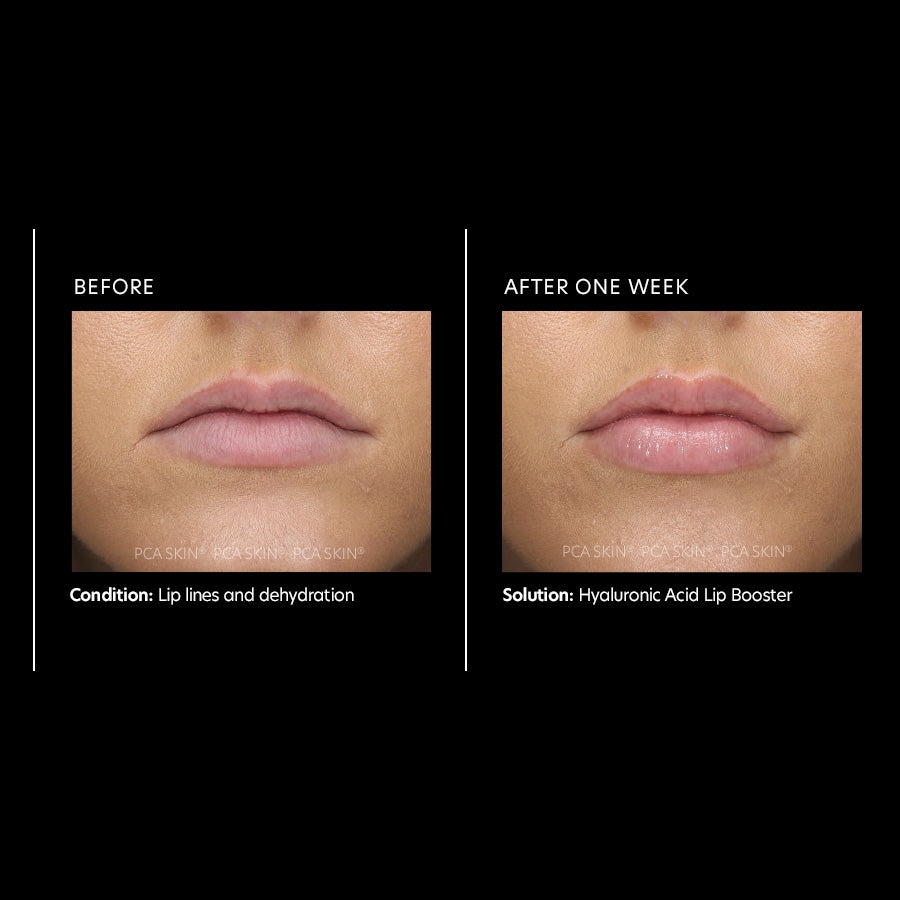 PCA Hyaluronic Acid Lip Booster