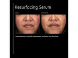 PCA Skin Resurfacing Serum